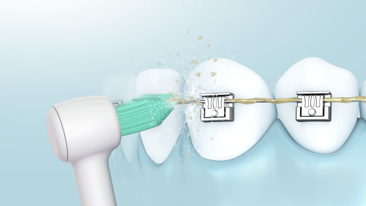 Panasonic Buse de rechange WEW0984 (2)